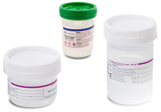 Pre-filled Speciman Containers